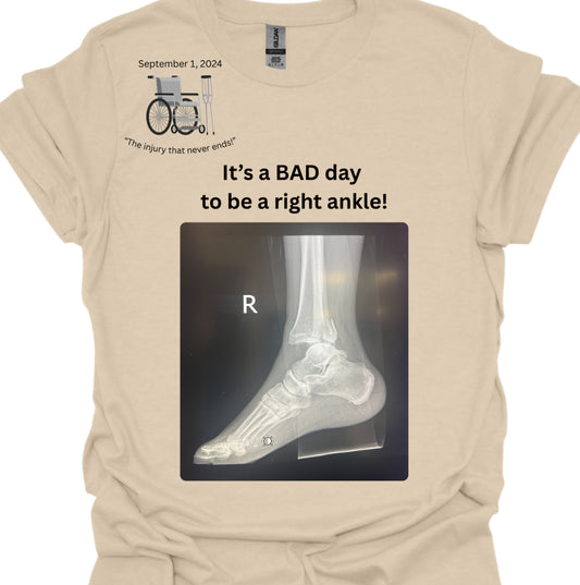 It’s a bad day to be a right ankle!